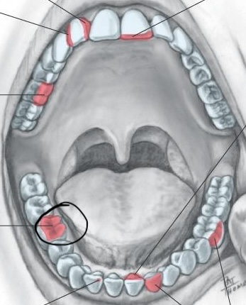 <p>Chewing surface for posterior teeth</p>