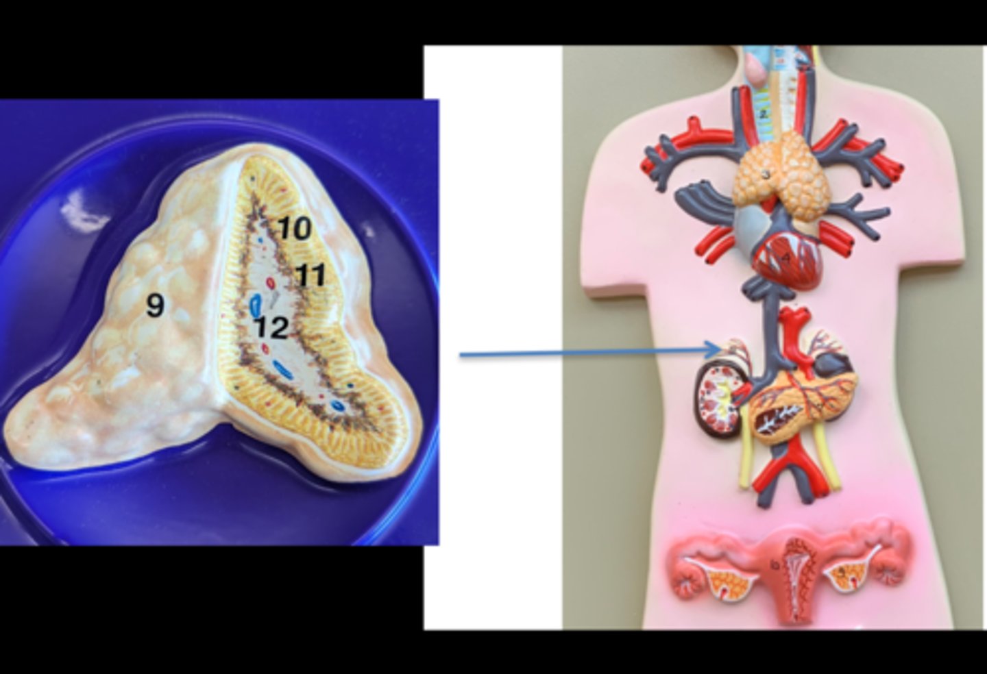 <p>Name this gland</p>