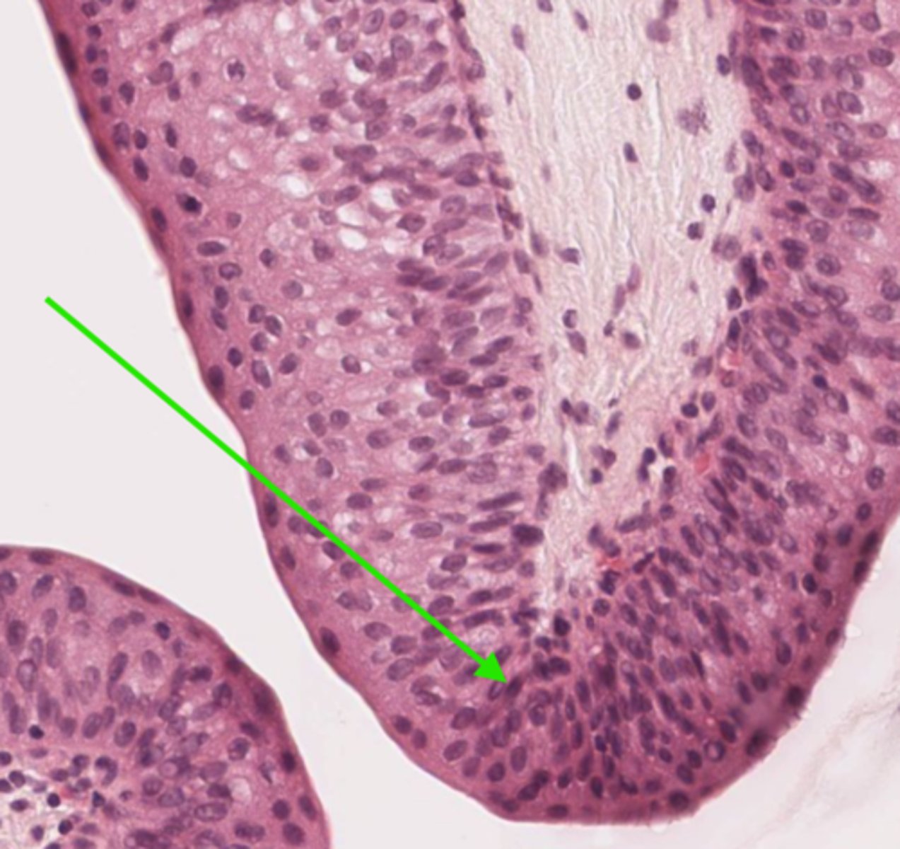 <p>Identify the layer of the ureter</p>