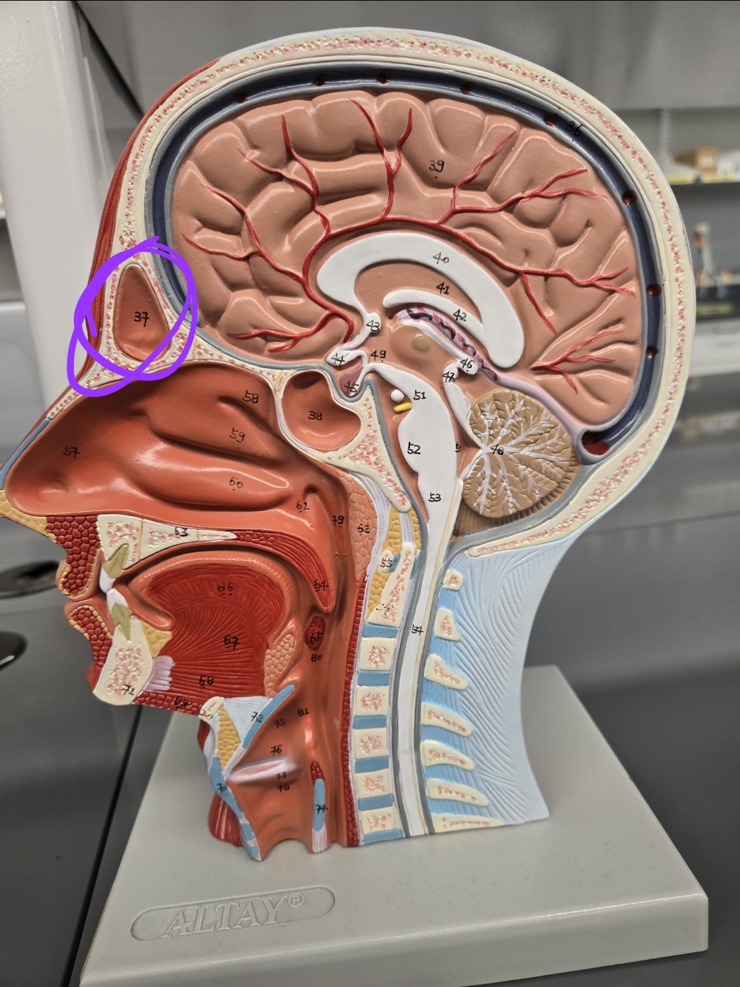 <p>Half head model: what structure is this?</p>