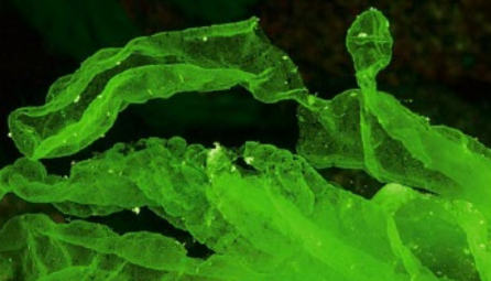 <p>Chlorophyta Chlorophyceae Tetraspora</p>