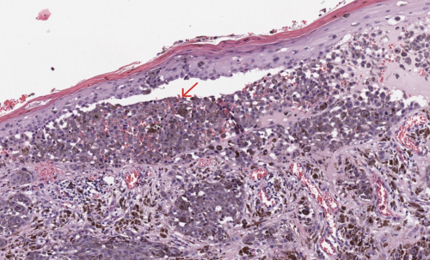 <p>Skin</p>