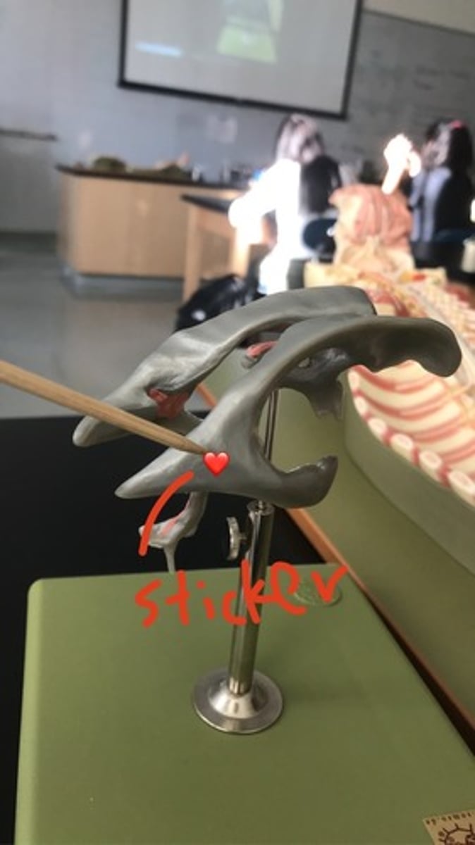 <p>As seen with sticker</p>