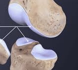 <p>Special type of connective tissue: contains gel-like matrix, chondrocytes or cartilage cells are found within small chambers called lacunae and are fully within the matrix, no blood vessels thus diffusion must bring in nutrients and remove wastes, heals slowly&nbsp;</p>