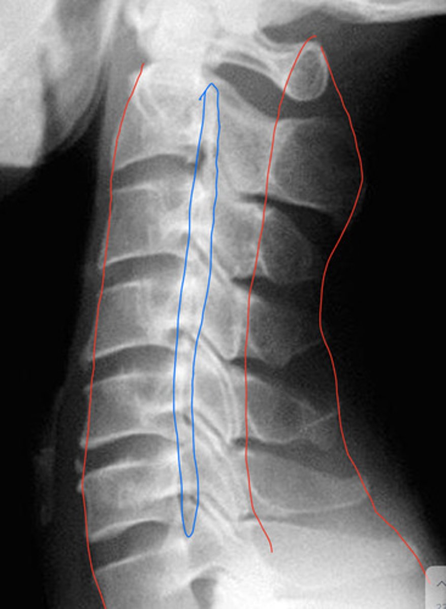 <p>What is the blue?</p>