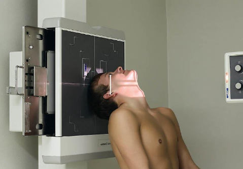 <ul><li><p>patient position:</p><ul><li><p>upright</p></li></ul></li><li><p>part position:</p><ul><li><p>hyperextend neck and rest vertex of head on Bucky</p></li><li><p>adjust head to place MSP perpendicular to IR plane</p></li><li><p>IOML parallel to IR</p></li></ul></li><li><p>respiration suspended</p></li><li><p>CR:</p><ul><li><p>horizontal and perpendicular to IOML</p></li><li><p>enters MSP ¾ inch anterior to level of EAM</p></li></ul></li><li><p>collimation:</p><ul><li><p>1 inch beyond the tip of the nose and on the lateral sides</p></li></ul></li></ul><p></p>