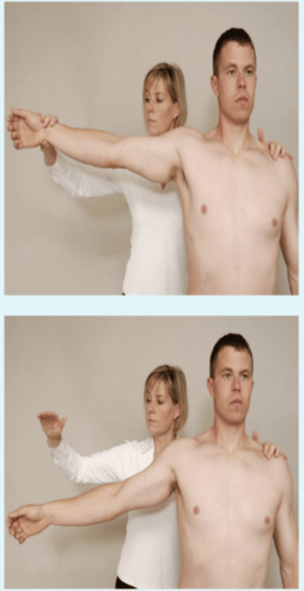 <p>- tear / full rupture of rotator cuff</p><p>(+): if pt is unable to return the arm to side slowly or has severe pain when attempt to do so</p>
