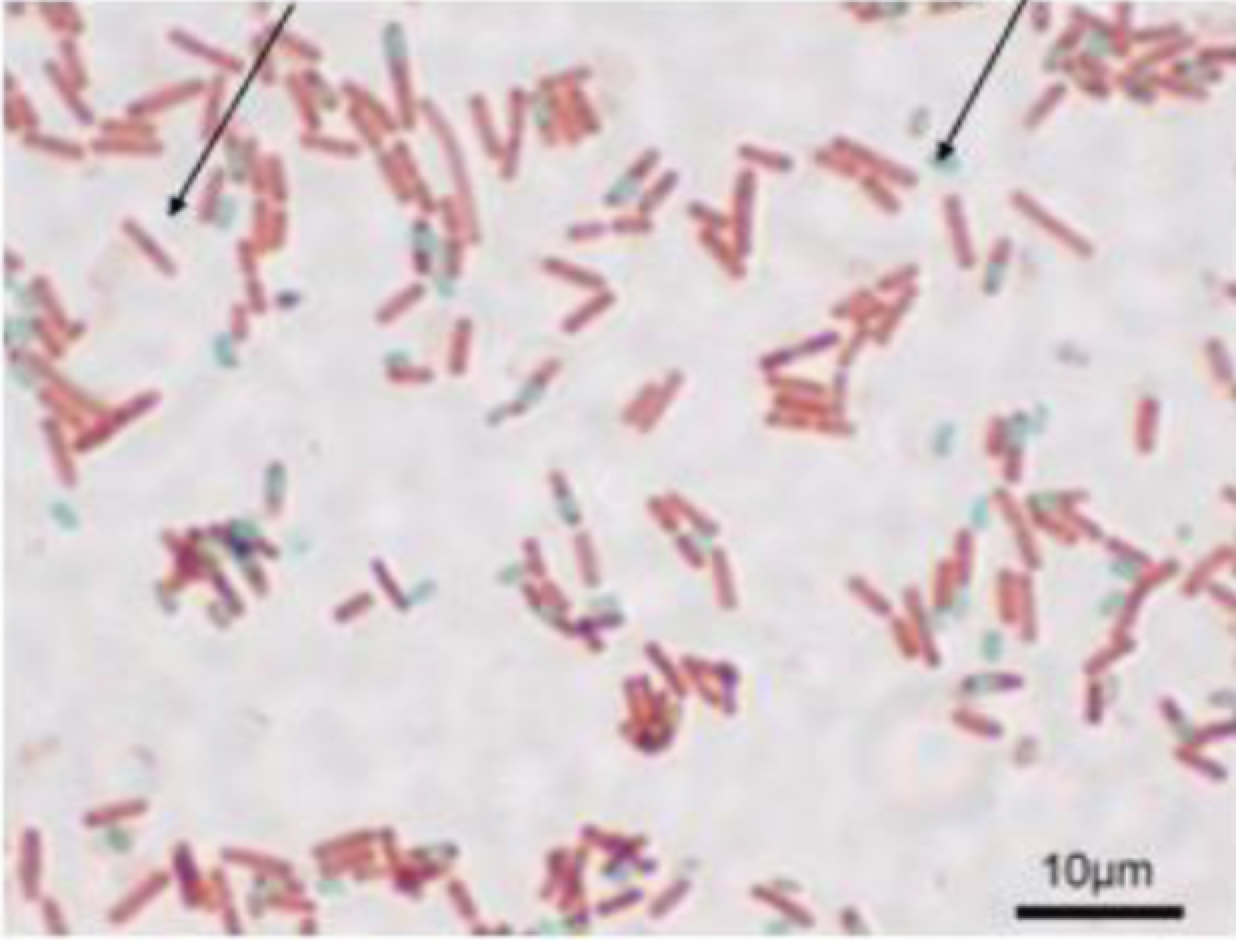 <p>What are the arrows pointing to?</p>