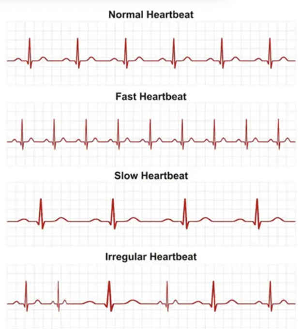 <p>Measure the <strong>R–R interval</strong> or the <strong>P–P interval</strong>.</p>