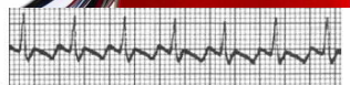 <p>What rhythm is this?</p>