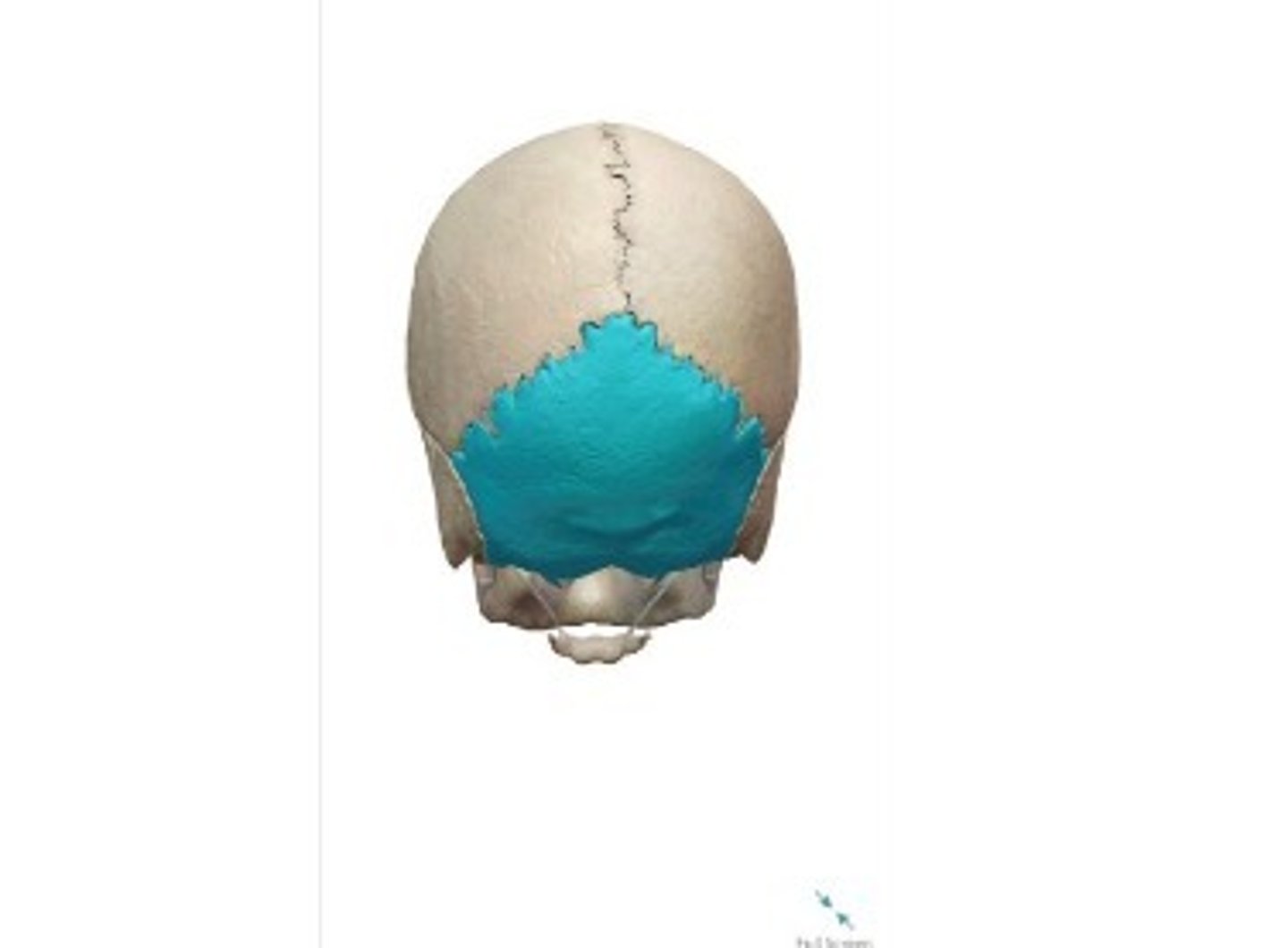 <p>What category of bone is it? What bone is it?</p>