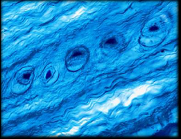 <p>Label the fibrocartilage </p>