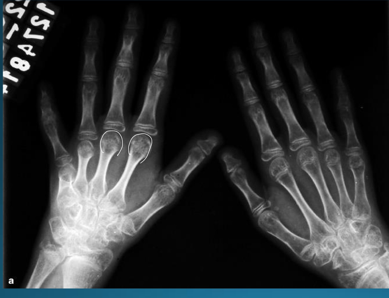 <p>what is the diagnosis?</p>