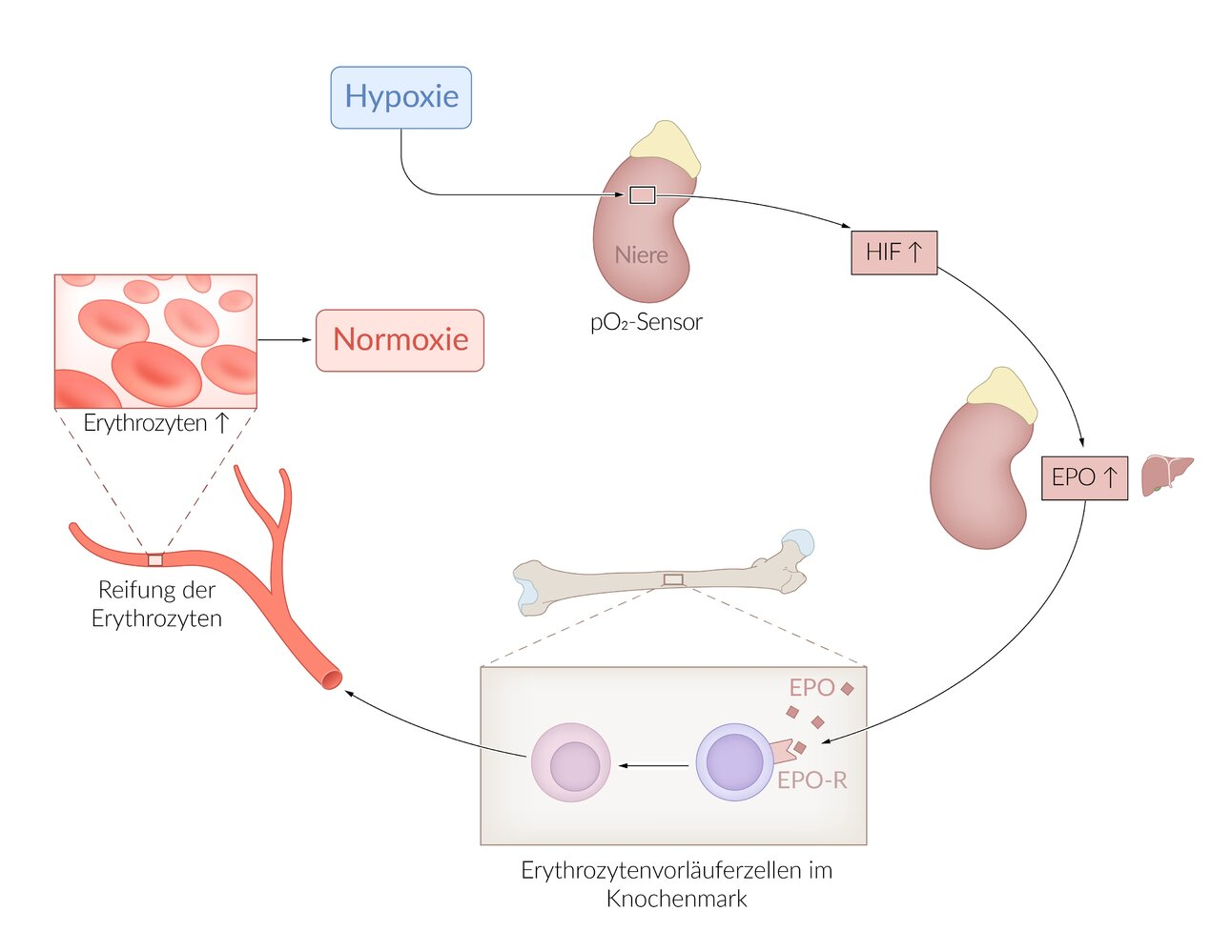 <p>B. The patient suffers from dialysis-dependent renal insufficiency with impaired endocrine kidney function.</p>