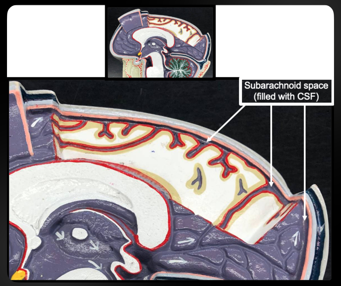 <p>Subarachnoid Space</p>