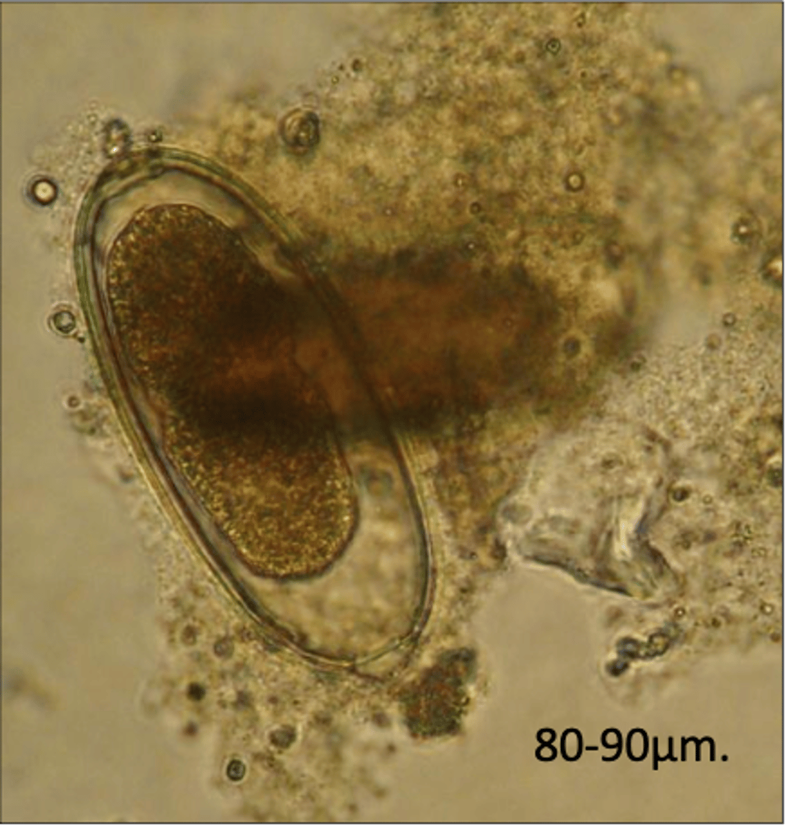 <p>Found in outdoor-reared chicken showing severe dyspnoea and poor FCR. What parasite species dies this egg belong to?</p>