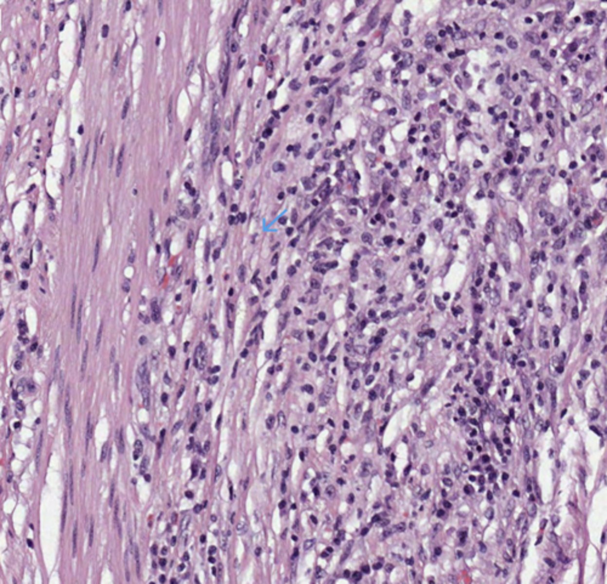 <p>Colon</p>