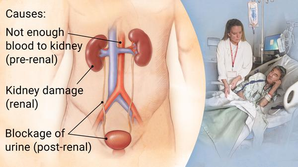<p><strong>Which of the following data would a clinician consider as most indicative of acute renal failure?</strong></p><p>A) Alterations in blood pH; peripheral edema</p><p>B) Increased nitrogenous waste levels; decreased glomerular filtration rate (GFR)</p><p>C) Decreased serum creatinine and blood urea nitrogen (BUN); decreased potassium and calcium levels</p><p>D) Decreased urine output; hematuria; increased GFR </p>