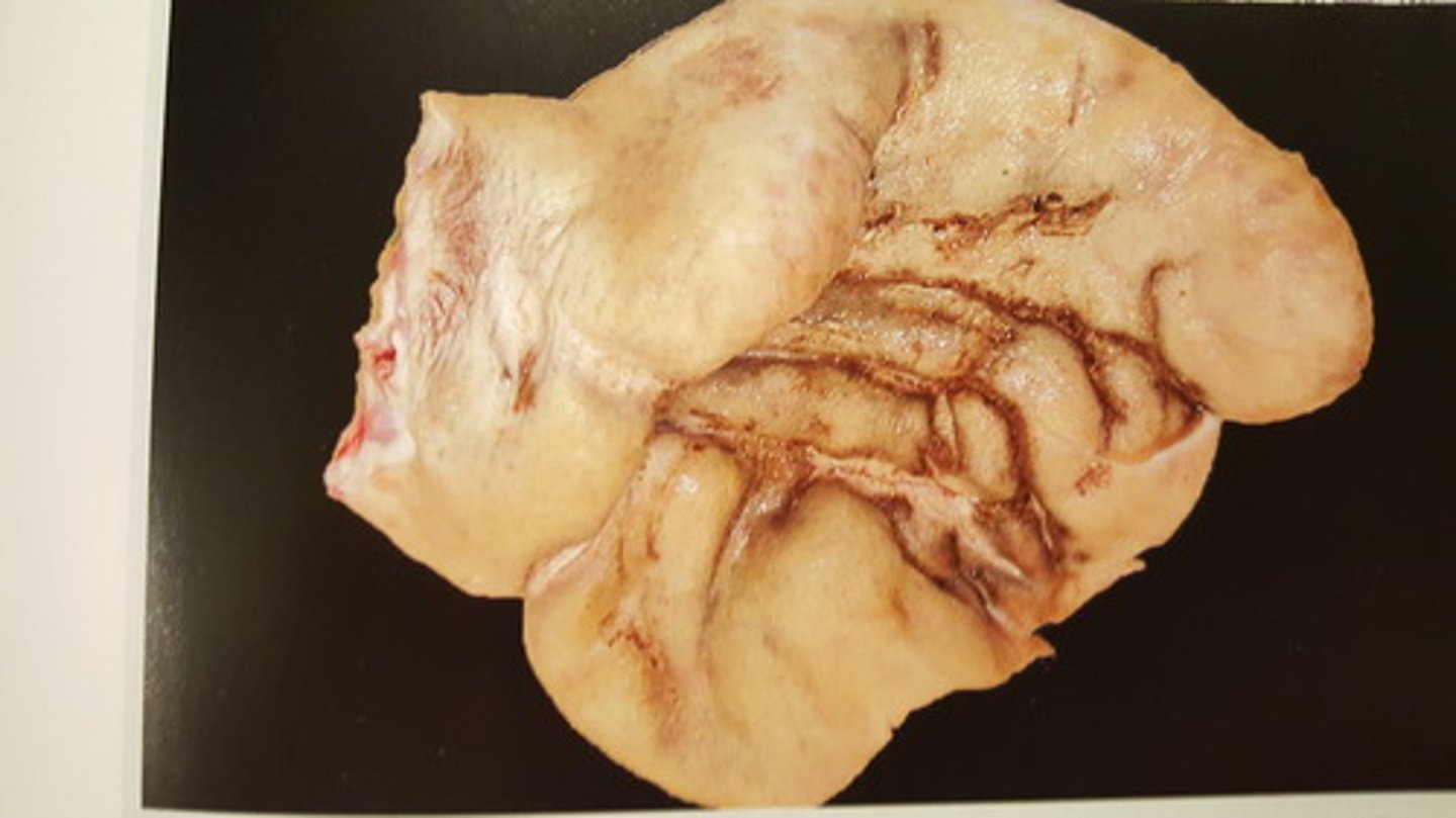 <p>Øre fra svin. Patoanatomisk diagnose? Ætiologi?</p>