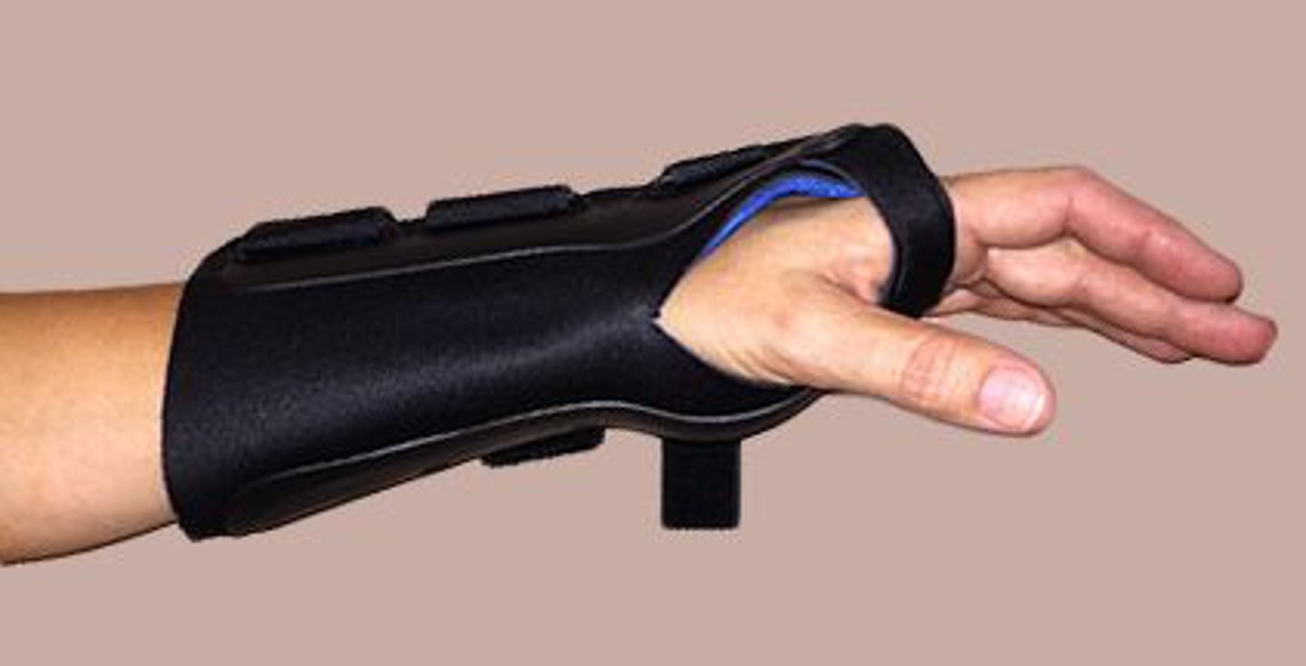 <p>The orthosis shown in the photograph is TYPICALLY used for a patient who has which of the following conditions?</p><p>1. Carpal tunnel syndrome</p><p>2. Osteoarthritis of the thumb (1st digit)</p><p>3. Dupuytren contracture</p><p>4. Postoperative flexor tendon repair</p>