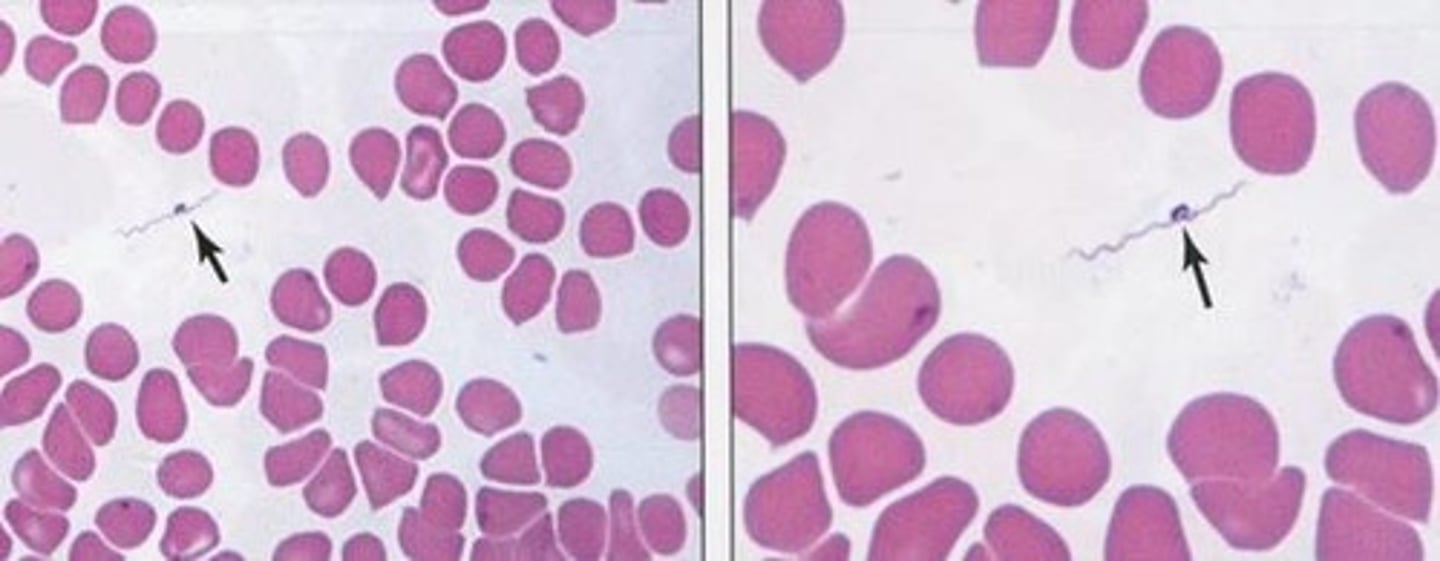 <p>Identify the shape of the extracellular bacteria in this blood smear.</p>