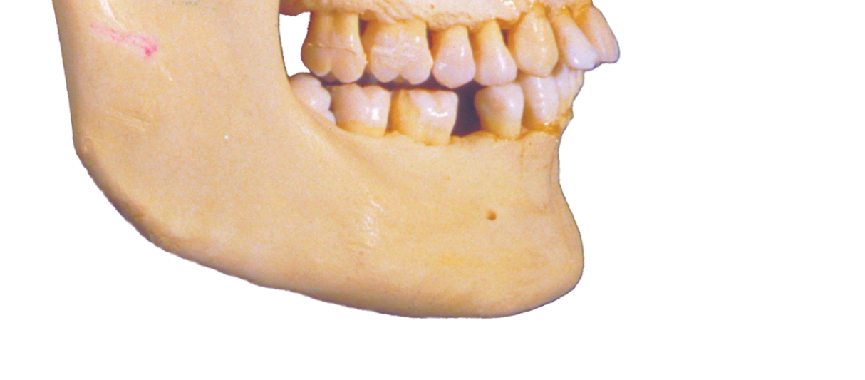 <p>What structure(bone)?</p>