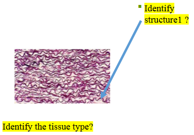 <p>What type of tissue is this?</p>