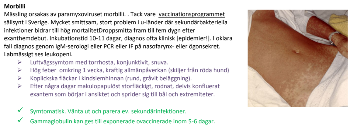 <p>Mäsling.</p>