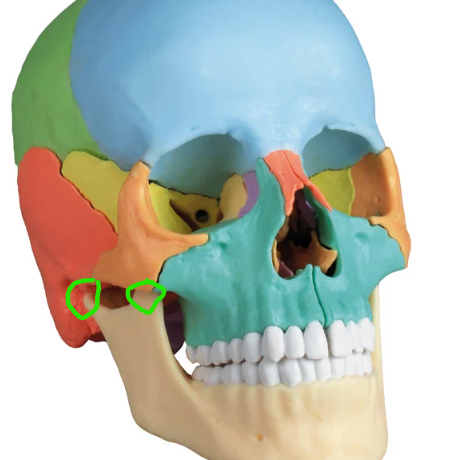 term image