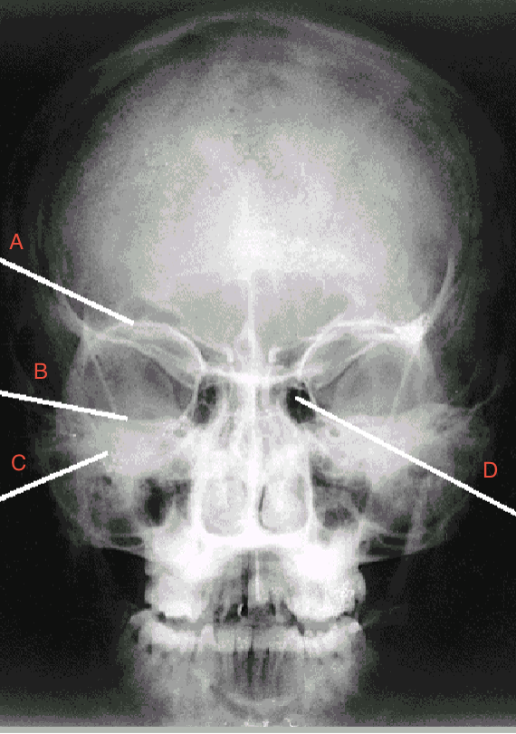 <p>what is A pointing to? </p>