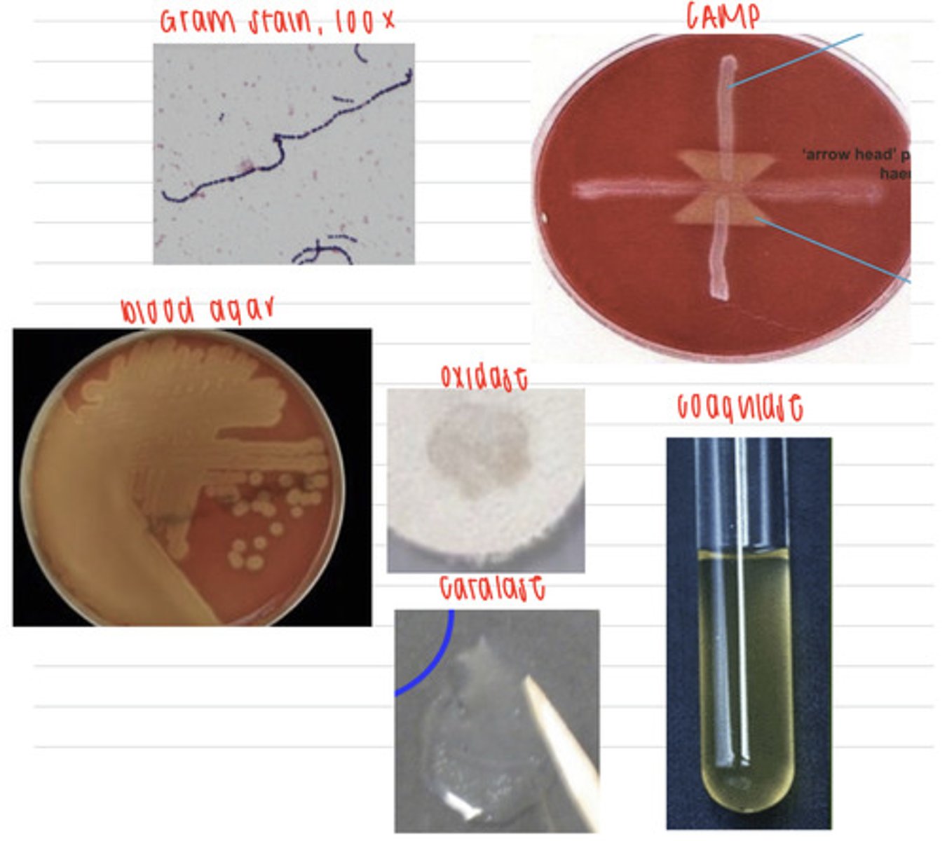 <p>a dog just had puppies, and some died before reaching 1 month because of septicemia. We take samples, and isolate them on non-enriched media (no growth), blood agar, and MacConkey agar (no growth). we also stain using the gram method and perform oxidase, catalase, CAMP, and coagulase tests. Here are the results.</p><p>What is the diagnosis?</p>
