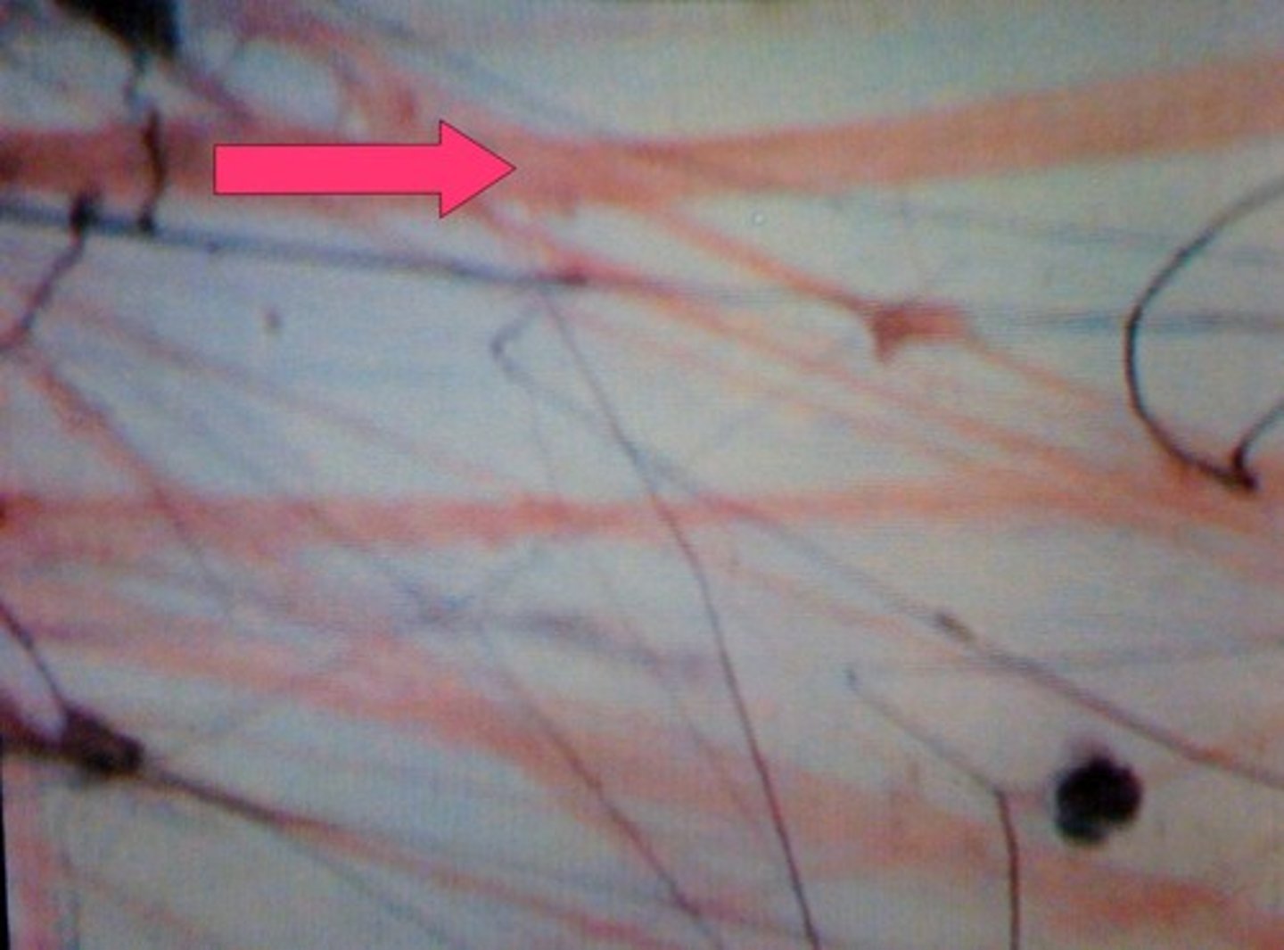 <p>Name the fiber indicated by the arrow.</p>