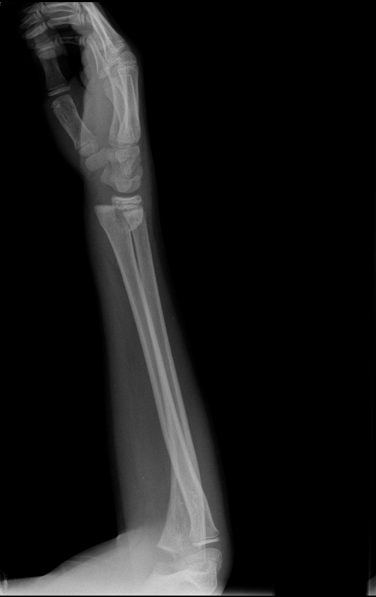 <p>Describe the abnormality demonstrated.</p>