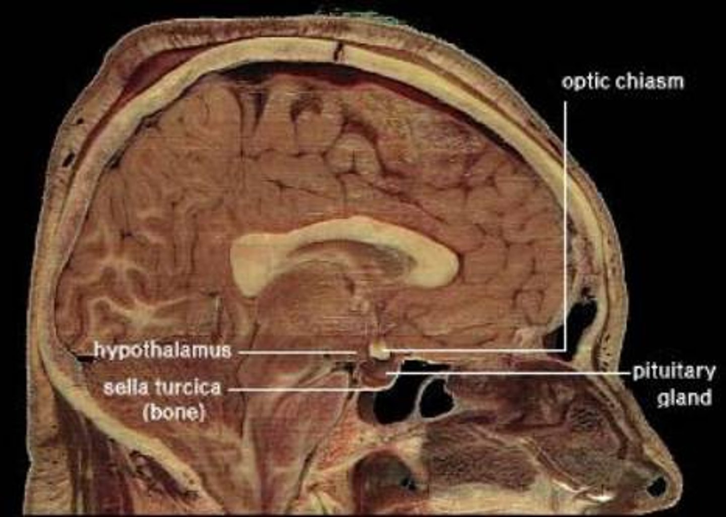 <p>The crossing of the optic nerves from the two eyes at the base of the brain.</p><p>Below the hypothalamus.</p>