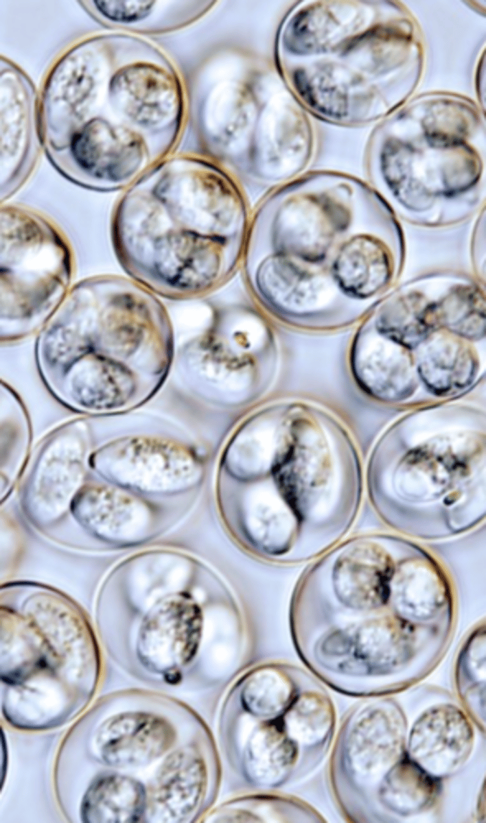 <p>Sources of infection</p><p>Oocysts</p><p>Resistant to the common disinfectants when used at usual concentrations but destroyed by ammonia and high temp </p><p>Might be transported by mice, rats, flies, boxes for eggs, tools etc.</p><p>Are introduced into new farms through contaminated equipment, vehicles, personnel etc.</p>