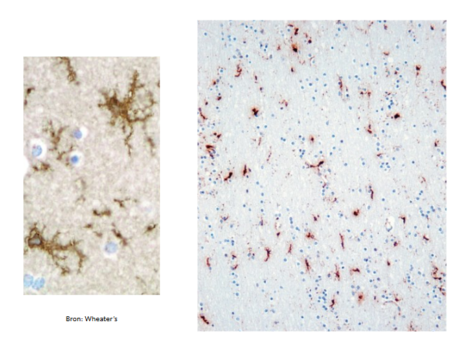 <p>CD68 = lysosomiale merker</p><ul><li><p>microglia = bruine celletjes</p></li></ul><p></p>