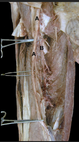 <p>Identify the structures from this<strong>&nbsp;Anterior</strong>&nbsp;<strong>View</strong> of the thigh’s Femoral Artery&nbsp;</p>
