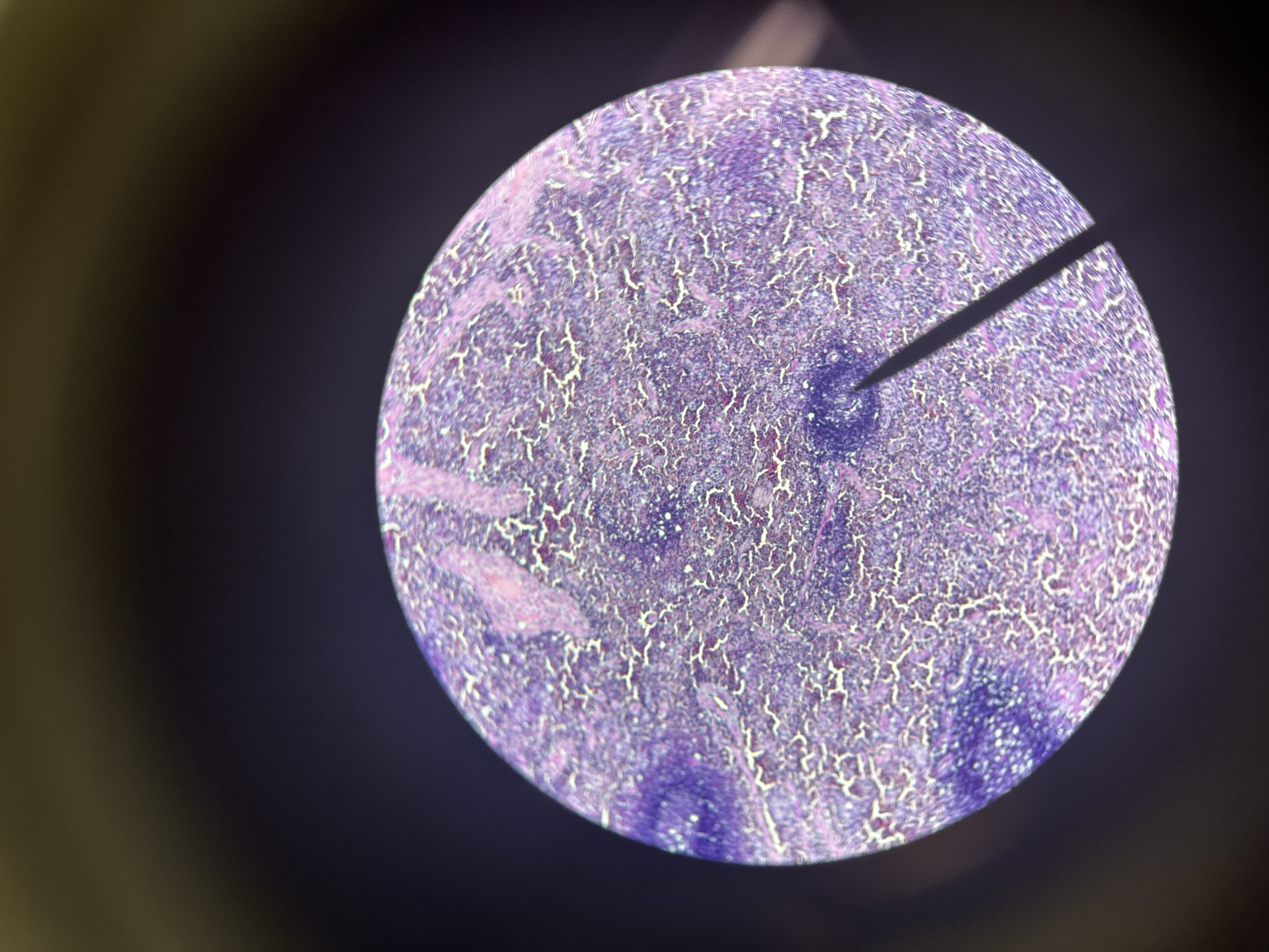 <p>Germinal center</p>