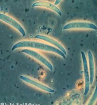 <p>sinusitis, </p><p>keratitis (contact lens soln), </p><p>onychomycosis (nail), </p><p>tinea pedia (athletes foot), </p><p>interrigo</p><p></p><p>more severe infn in burns, decubitis ulcers, septic arthritis assoc w steroid injections</p><p>invasive infns in AML, hematopoietic stem cell, or prolonged neutropenia pts</p>