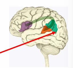 <p>temporal lobe</p><p>near wernicke’s area </p><p>(green)</p>