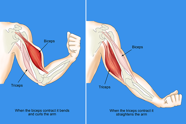 <p>biceps pop out when arm is contracted, triceps when arm is straightened</p>