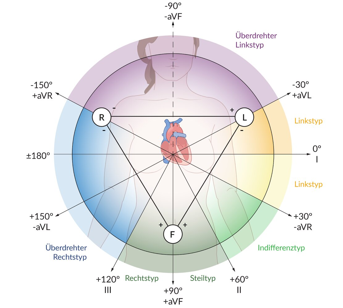 <p>C. Chronically increased flow resistance in the pulmonary arteries</p>