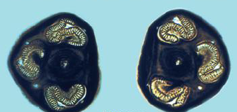 <p>This spiracle belongs to which fly larvae?</p>