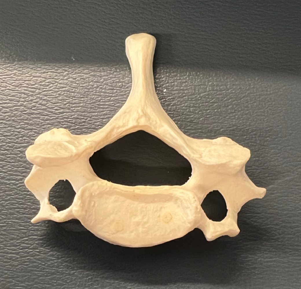 Which group does this vertebrae belong to? 