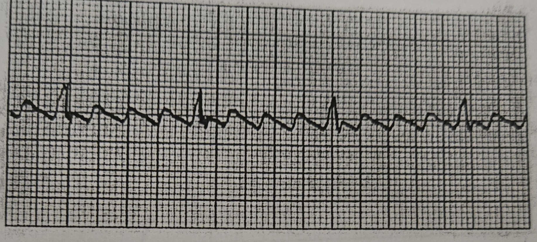 <p>What Rhythm is this?</p>