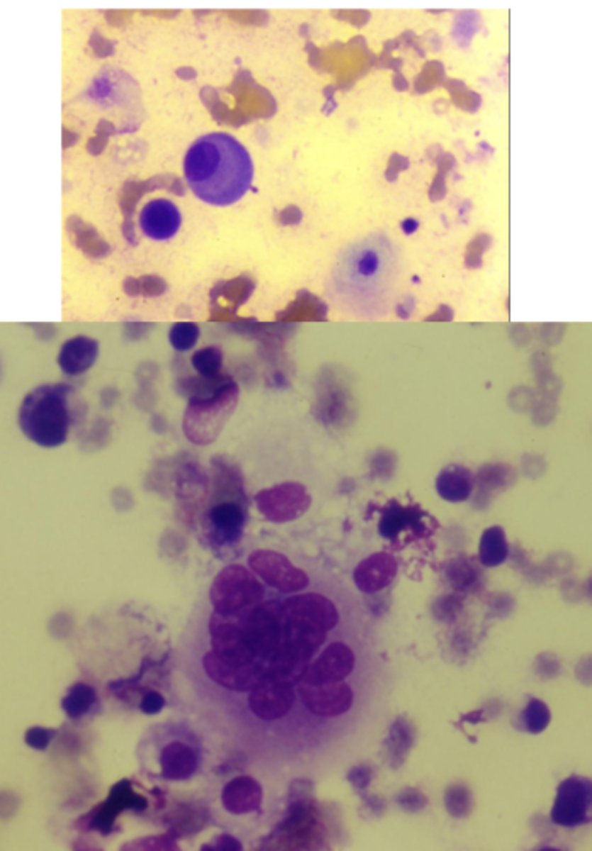 <p>This is a cytology slide taken from a long bone of a large breed dog.</p><p>What is your top differential?</p>