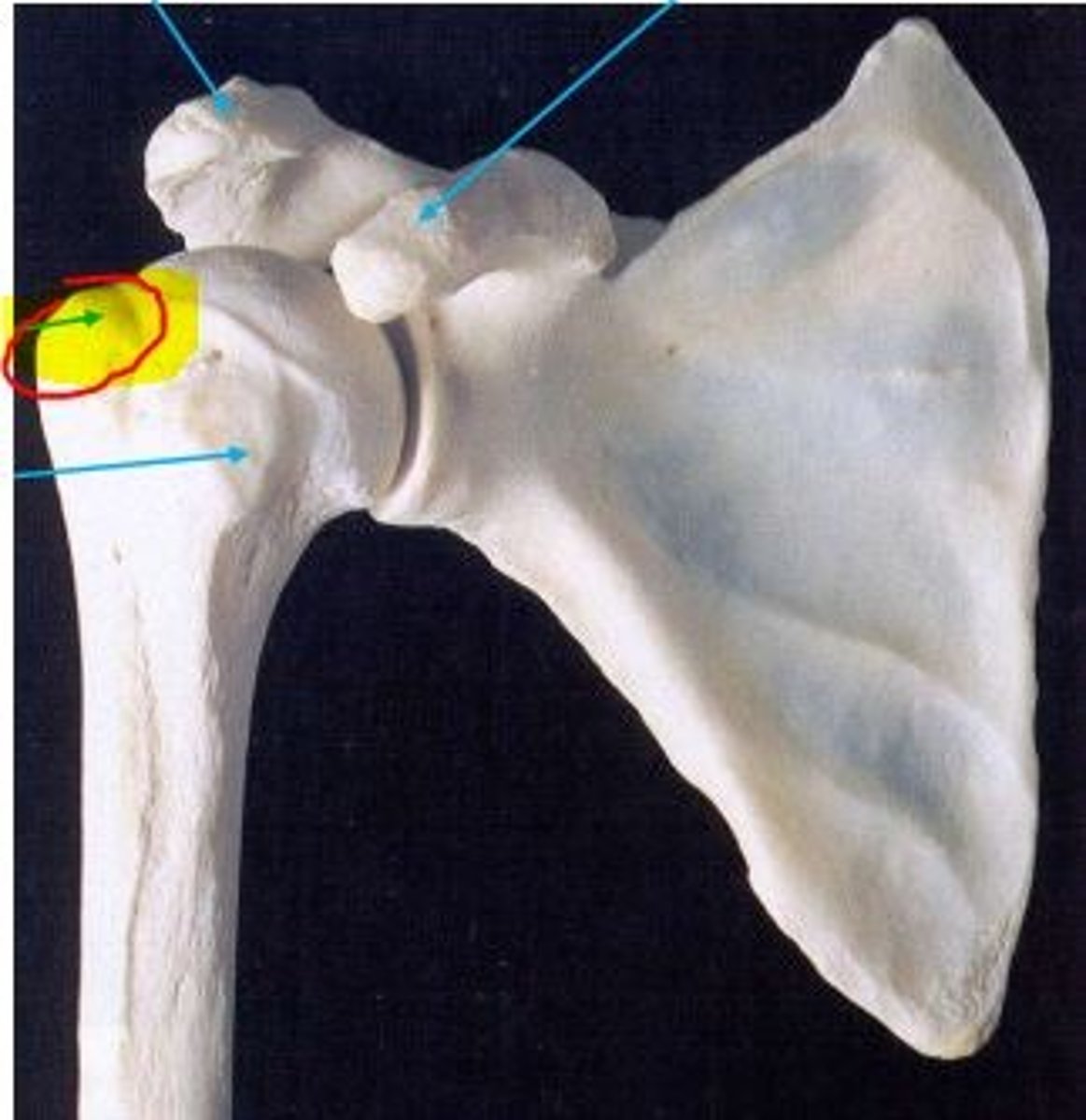 <p>Greater tubercle</p>