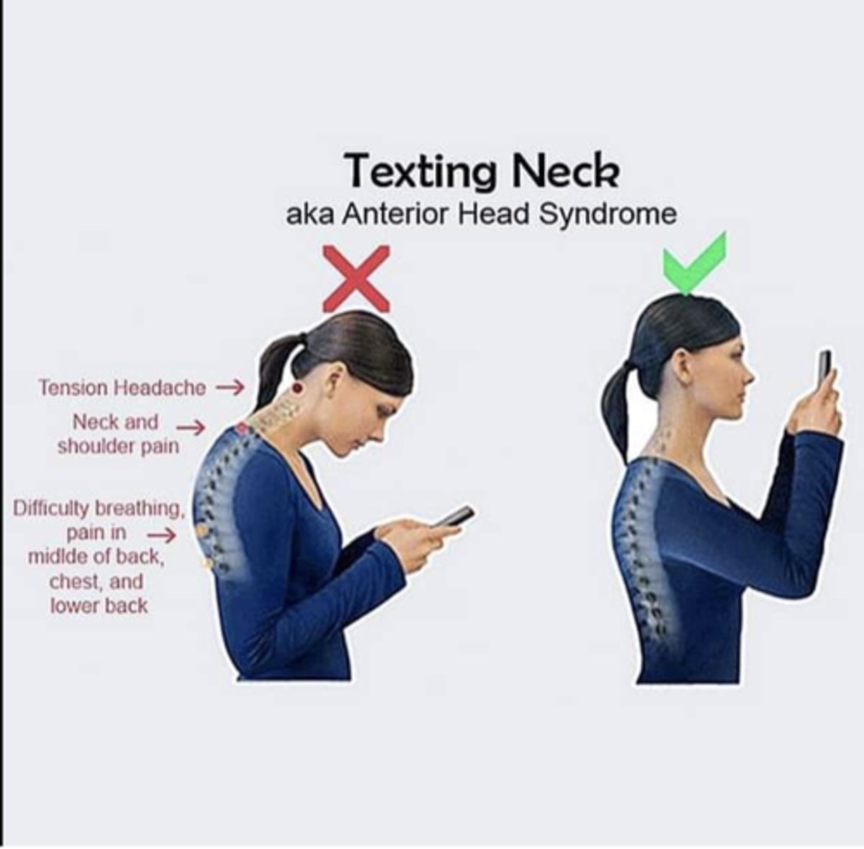 <p>The neck is subcategorized into what to subregions</p>