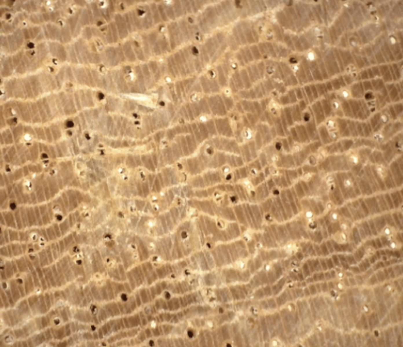 <p>Light brown, white and orange deposits, concentric parenchyma, light</p>