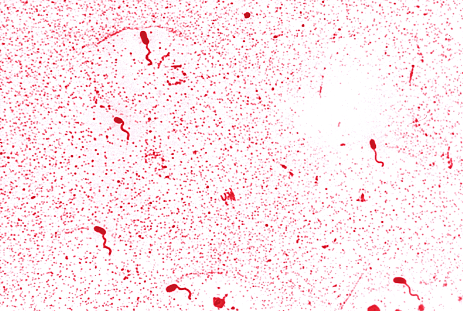 <p>spiral with single tail</p>